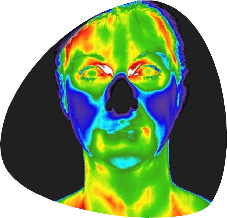 What is thermography?